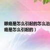 眼癌是怎么引起的怎么治疗（眼癌是怎么引起的）