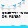 地表可超70℃！出现这些症状要警惕，严重可致命