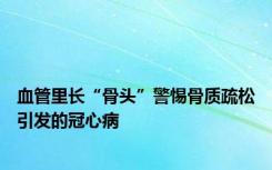 血管里长“骨头”警惕骨质疏松引发的冠心病