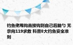 钓鱼佬甩钩直接钩到自己后脑勺 无奈向119求救 科普8大钓鱼安全准则