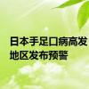 日本手足口病高发 17个地区发布预警
