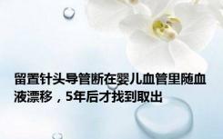 留置针头导管断在婴儿血管里随血液漂移，5年后才找到取出