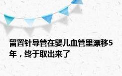 留置针导管在婴儿血管里漂移5年，终于取出来了