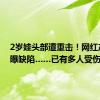 2岁娃头部遭重击！网红产品被曝缺陷……已有多人受伤