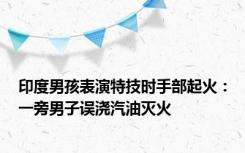 印度男孩表演特技时手部起火：一旁男子误浇汽油灭火