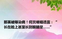 那英被曝染病！何炅哽咽透露：“长在脸上甚至长到眼睛里……”