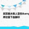 民警跳水救人受伤&#32;岸边留下血脚印