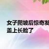 女子爬坡后惊奇发现膝盖上长脸了